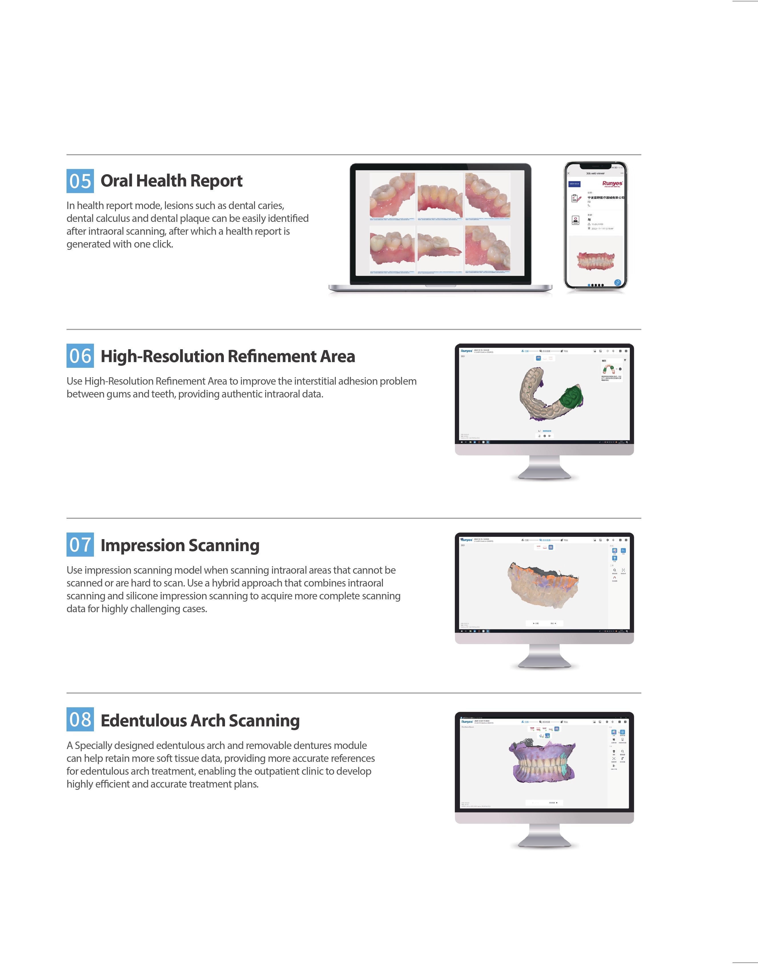 Runyes Intraoral Scanner 3DS V5