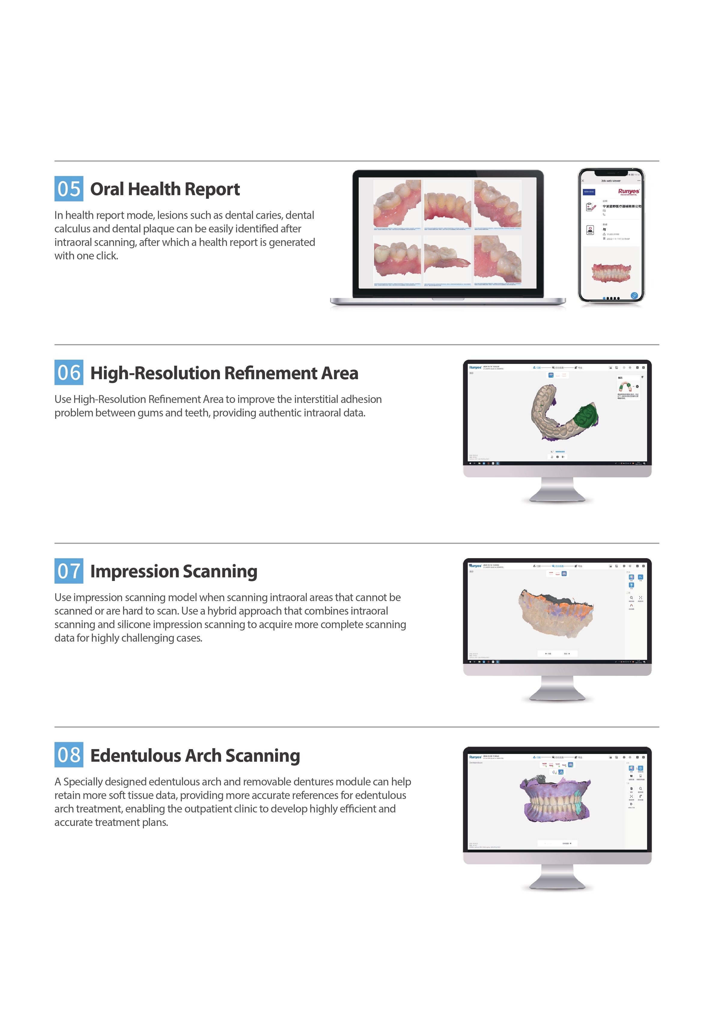 Runyes Intraoral Scanner 3DS V6