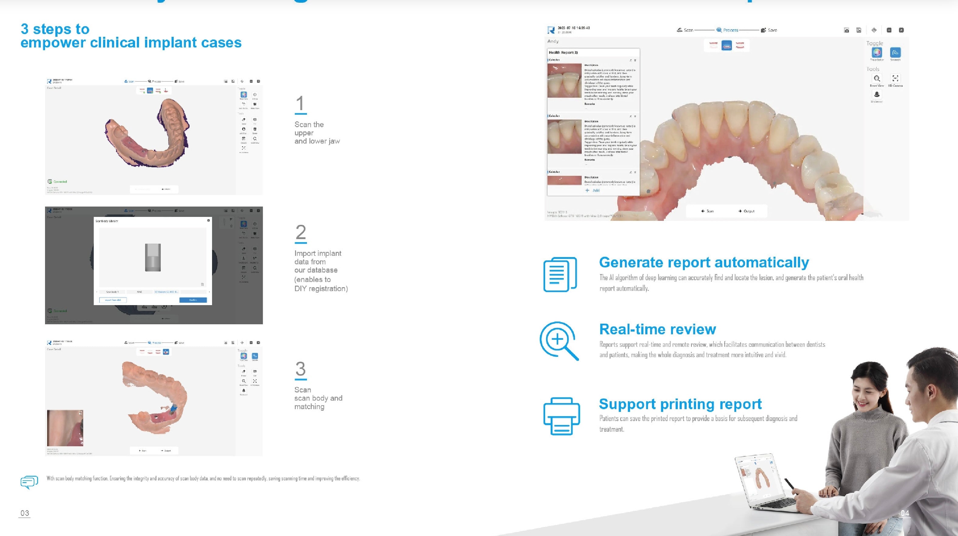 Runyes Intraoral Scanner 3DS V3 Pro